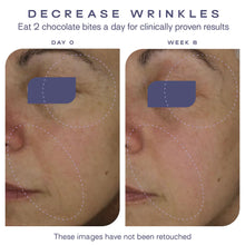 Load image into Gallery viewer, Skin Glow Bites
